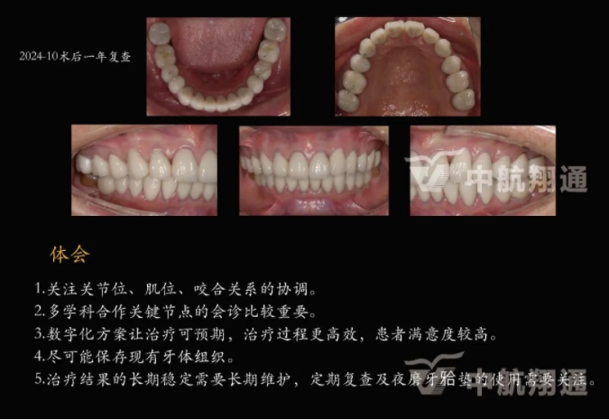 多學(xué)科聯(lián)合治療重度磨耗咬合重建?例
