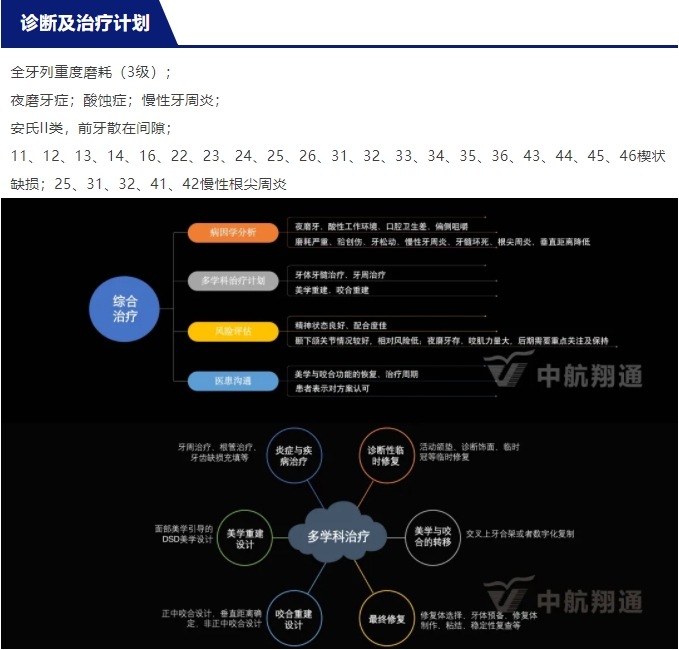 2024華人美學臨床病例大賽獲獎病例|以美學設(shè)計為導向的牙列重度磨耗患者全牙列咬合重建