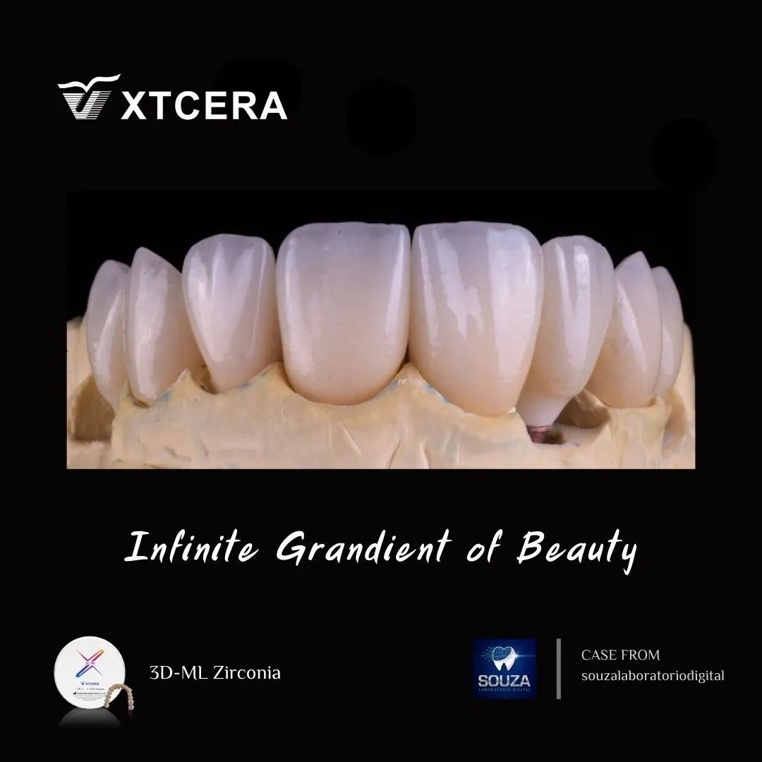 中航翔通3D ML Zirconia|匠心臻選·定制級美學修復