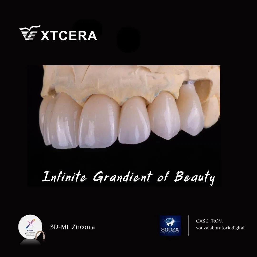 中航翔通3D ML Zirconia|匠心臻選·定制級美學修復