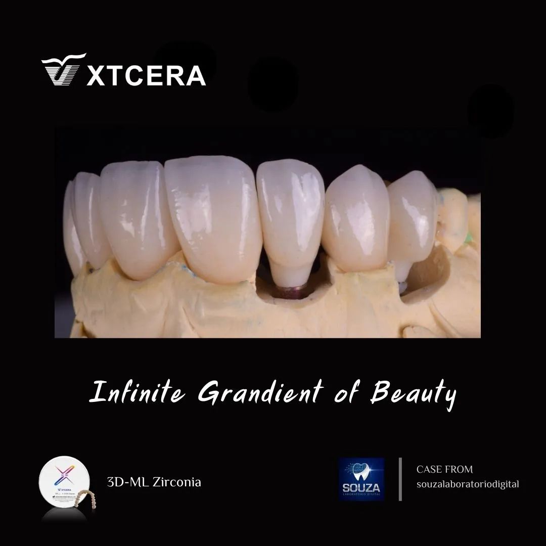 中航翔通3D ML Zirconia|匠心臻選·定制級美學修復